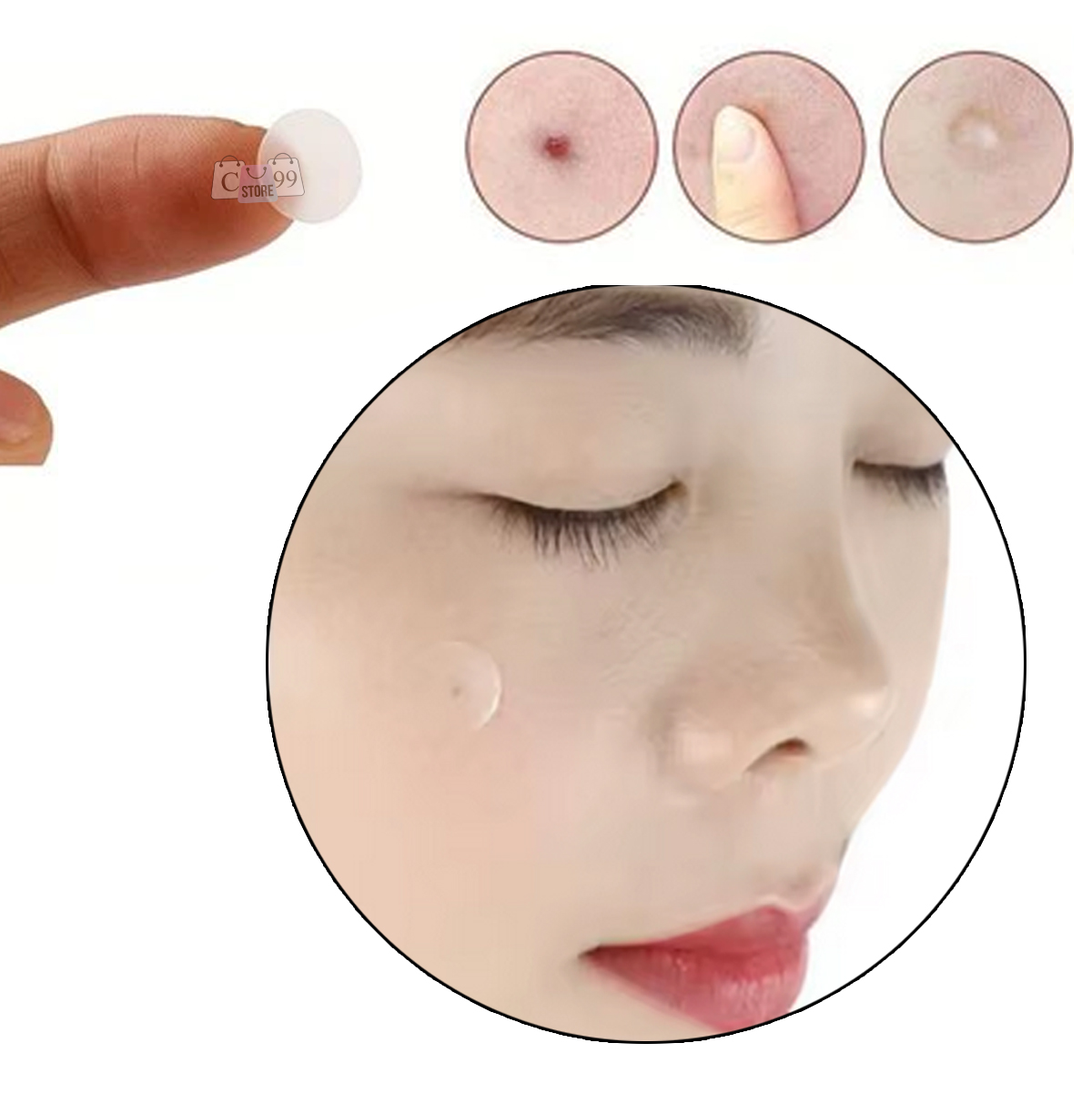 Parche Para Acné y Espinillas Sticker